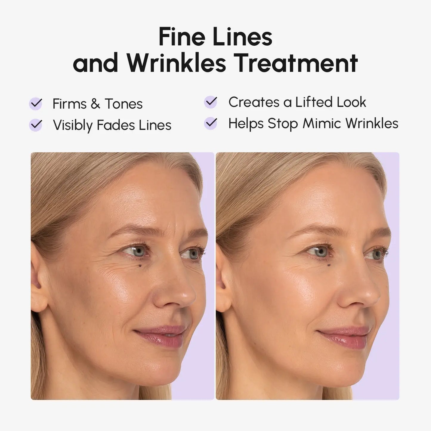 Anti-wrinkle Tape Patches on